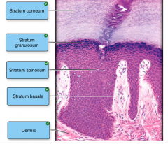 keratinized stratified squamos epithelium