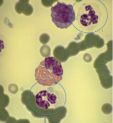 Bekæmpelse af infektion og fagocytose af bakterier. Deres granula farves ikke særlig kraftigt, hvilket de kan kendes på.