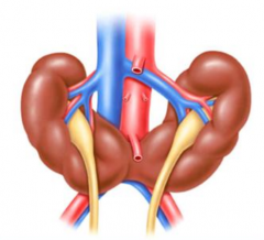 What genetic issue is Horseshoe kidney associated with?