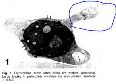 When enzymes have digested the cytoplasmic organelles, the cytoplasm becomes vacuolated and appears MOTHEATEN