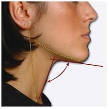Cervicomental angle - angle between the vertical portion of the neck and the transverse portion of the submandibular region, correlates to the position of the hyoid relative to the mandible