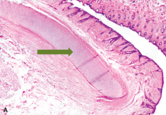 


Review book "funnel like plate of elastic cartilaged sandwiched between two layers of skin"
According to her there is keratinized stratified squamous epithelium 

