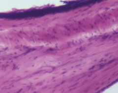 * Outer epidermis of stratified squamous epithelium
* Middle dense connective tissue
* Inner cuboidal epithelium 