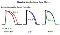 Class IA Anti-Arrhythmics

NAMES & MOA