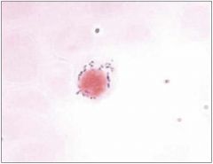Identify cell and related conditions