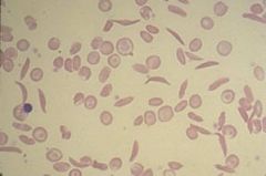 Identify cell and related conditions