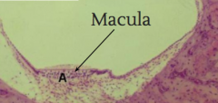 Simple squamous epithelium on either side lining boney labryinth and then you are going to get the two types of hair cells