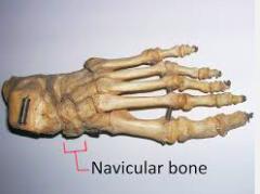 Osteology of
the foot
Navicular
 
• Proximal, concave surface → talus
• Dorsal/medial aspects wider than plantar/lateral aspects