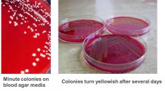 grows on blood & chocolate agar, requires hemin for growth


 


yellow in-grown colonies