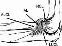 PLRI of the elbow = 2^ open elbow dislocation,  tx is LUCL recon w/ palmaris tendon graft.