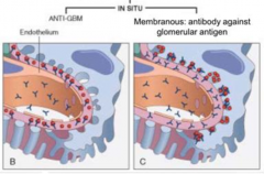 Antibodies that target the GBM or glomerular antigens