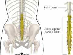 -terminal lumbar and sacral nerves
-compression leads to serious pain.