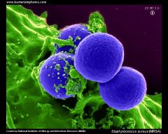 Staphylococcus aureus: