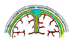Dura Mater (yellow)- external meningeal layer. Thick.

Arachnoid (green)- cover the general surface of the brain. Intermediate meningeal layer. Thin membrane.

Pia Mater (red)- internal meningeal layer. Adheres to surface of brain; the only la...