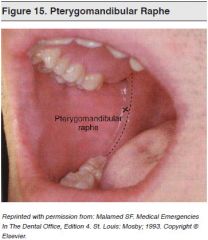 It is the ridge that extends from the upper to lower alveolus (between back molars)