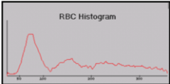 Abnormal RBC histogram