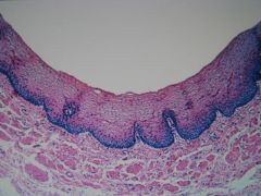 low magnification section of an _____. This type of epithelium is called ____ ____ _____. Inferior to the epithelium is the connective tissue layer, which in the digestive tract is called ___ ___. Surrounding this are bundles of smooth muscle fibe...