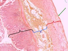  The black bracket is the mucosa  The blue bracket is the submucosa
The red bracket is the muscularis
The green arrow indicates the serosa.  