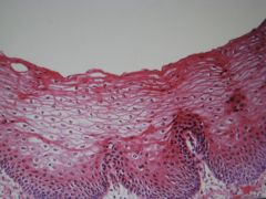 medium magnification of the ___, showing ___ ____ ____. The ___ cells are cuboidal, divide continously toward the surface. As the cells surface they change shape to flat or squamous appearance. The cells are shed at ____ __. 