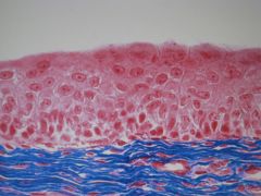high magnification of ___ epithelium from a ____. Below the epithelium are the dense, blue staining ___ fibers of the connective tissue,pink smooth muscle fibers and numerous blood vessels. 