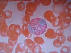 high magnification of ___. Bright red ____ fills its cytoplasm