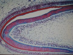 medium magnification of a ____. ___ ____ tissue forms pulp and is located adjacent to the dense cells _____ that produce ____. These cells are irregular with delicate cytoplasm extensions. 