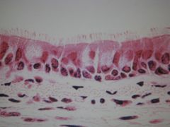 high magnification of ____ tract in the ____ showing ___ _____ with cilia and ___ cells overlying ___ connective tissue. Below the basement membrane of the epithelium, loose and irregular ___ fibers are sectioned in transverse plane and collagen f...