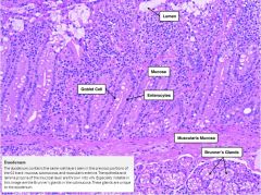 Mucosa del duodeno:Epitelio: cilíndrico simple con 
1. ENTEROCITOS: células absortivas con microvellosidades, 2. células CALICIFORMES que producen MUCINA y  otras dos que están en la base de la CDL): APUD y PANETH que producen LISOZIMA.
que ...
