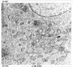 Binyrebark
H 181 viser deler av en celle i binyrebarken (sannsynligvis fra zona fasciculata). Enkelte store lipid-”dråper” sees i kjertelcellen, dessuten rikelig mitokondrier og glatt endoplasmatisk retikulum.