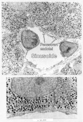 Binyremarg
Øverste bilde viser en sinusoide omgitt av chromaffine celler. Bildet under viser mer detaljert granula omgitt av membran og forskjellige organeller. Det fenestrerte endotelet er tydelig.