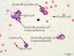 - Eosinofil granulocytt, monocytt, trombocytt, nøytrofil granulocytt som er segmentkjernet, erytrocytt og lymfocytt

Det er ikke funnet basofile granulocytter i dette utstryket.