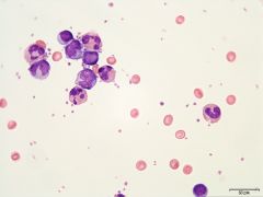 Spørsmål 1: Hvilke celler ser du fra dette leukocyttanrikede blodutstryket?