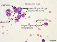 - Lymfocytt, erytrocytt, nøytrofil granulocytt som er segmentkjernet, monocytt, trombocytt og nøytrofil granulocytt som er stavkjernet.

Det er ikke funnet basofile granulocytter i dette utstryket.