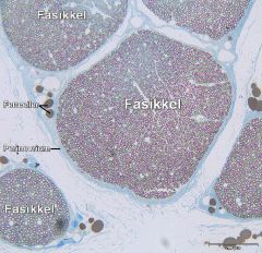 Nervus ischiadicus
Spørsmål 1: Ser du noen fettceller her?
- Fettcellene er farget lysebrunt i dette snittet og ses ved siden av perinevrium