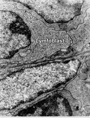 Lymfoblast