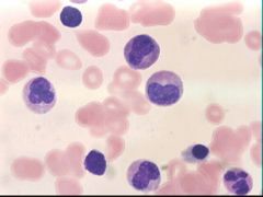 hematology lab Flashcards - Cram.com