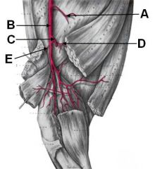Bryan - Gross Anatomy - Vessels of the Pelvic Limb - Winter 2010 ...