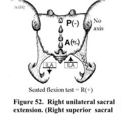 sacral somatic dysfunction