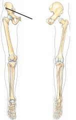 Gross Anatomy Unit 4: Pelvis and Femur Bones Foreign Language