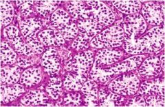 Unit 10 - 1 Pathology Flashcards - Cram.com