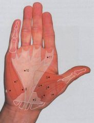 NS UE Hand Muscles Flashcards - Cram.com